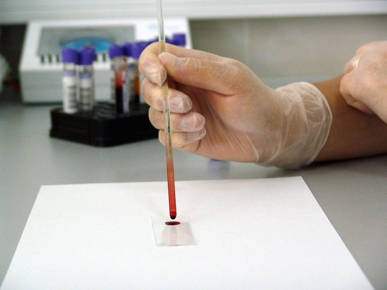 科学家引导HIV转变立场，一场与艾滋病毒的独特对抗